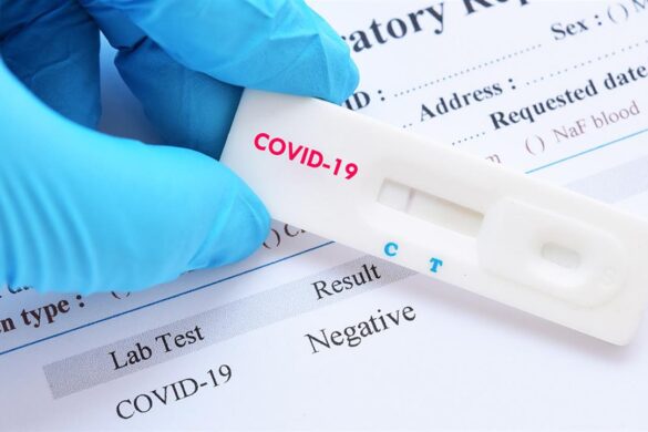 ΠΦΣ: Συνέχιση της δωρεάν διάθεσης των self tests από τα φαρμακεία για Ιούλιο και Αύγουστο