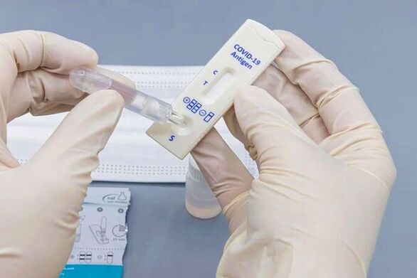 Αχαΐα: Τα σημεία που θα γίνουν rapid tests την Τετάρτη 6 Μαρτίου 2024
