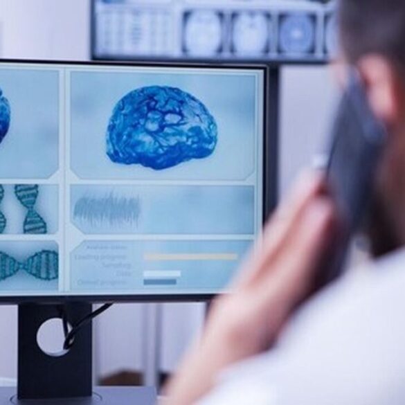 Alzheimer: Ο Όμιλος Affidea επενδύει στην Τεχνητή Νοημοσύνη για την διάγνωση της άνοιας