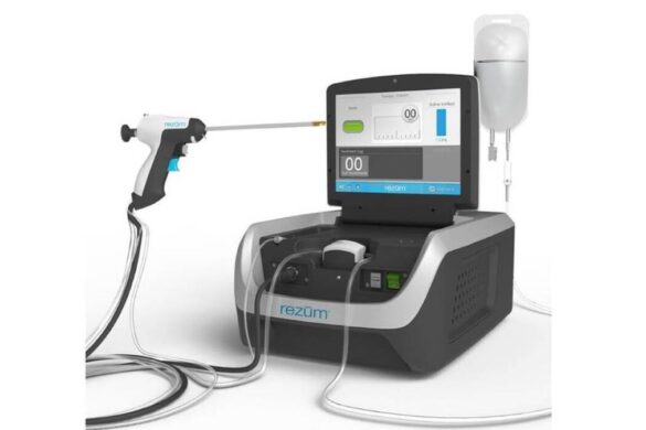 Πάνω από 20 επιτυχημένες επεμβάσεις σε τρεις μόλις μήνες για τη μέθοδο Rezum στην Ελλάδα!