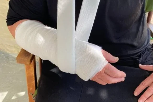 Αγρίνιο: Έσπασαν το χέρι ηλικιωμένης για να την κλέψουν!