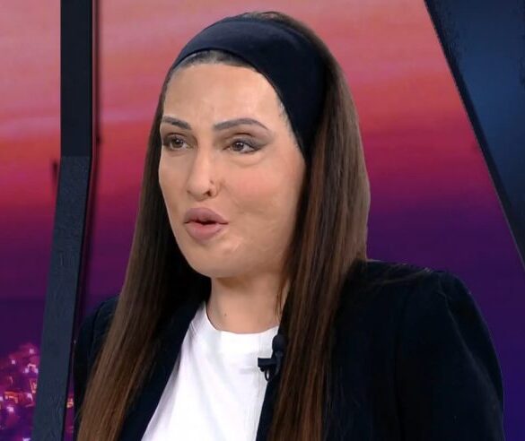 Ιωάννα Παλιοσπύρου για τυχόν αποφυλάκιση της γυναίκας που της έριξε βιτριόλι: Είναι εγκληματίας