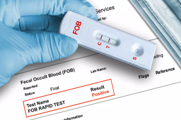 Self test παχέος εντέρου: Όσα πρέπει να γνωρίζουν οι δικαιούχοι για την πρόληψη του καρκίνου