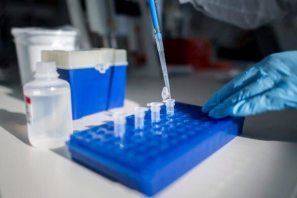 Έρευνα: Η φυσική ανοσία μετά από λοίμωξη Covid-19 διαρκεί τουλάχιστον έξι μήνες