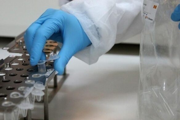 Μελέτη: Πόσο δραστικά είναι τα μονοκλωνικά αντισώματα έναντι του κοροναϊού