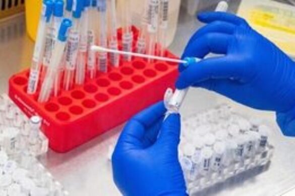 Όσοι έχουν μακρά Covid-19 μετά από 12 μήνες, θα έχουν και μετά από 18, σύμφωνα με βρετανική έρευνα