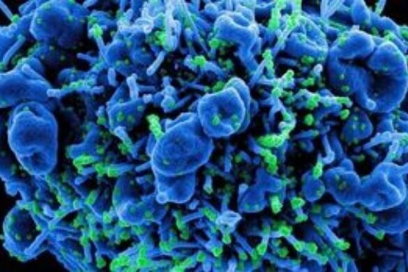 Έρευνα: Ένας στους τέσσερις με μακρά Covid-19 εμφανίζουν σημάδια αυτοάνοσης νόσου ένα χρόνο μετά